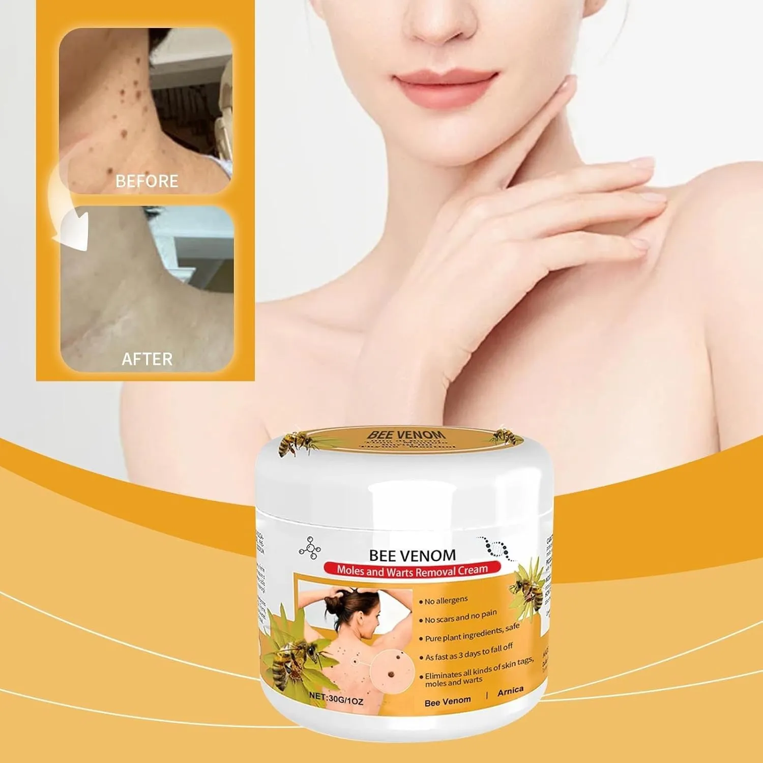 NEW Bee Venom Mole and Wart Treatment Cream, Bee Venom Repair Cream, Bee Venom Wart, Bee Venom Mole, Bee Venom Cream for Skin, Applicable to male and female skin (1pc)